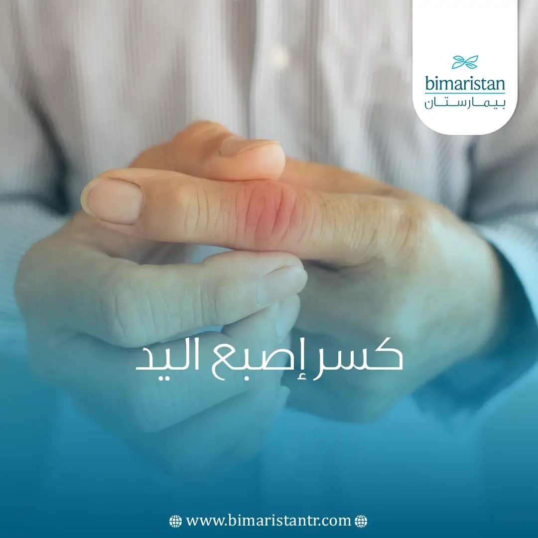 كسر إصبع اليد
