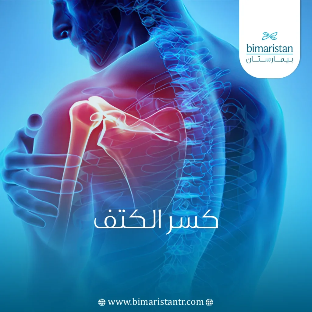 صورة غلاف لمقالة كسر الكتف