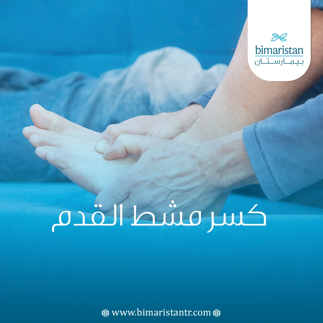 كسر مشط القدم