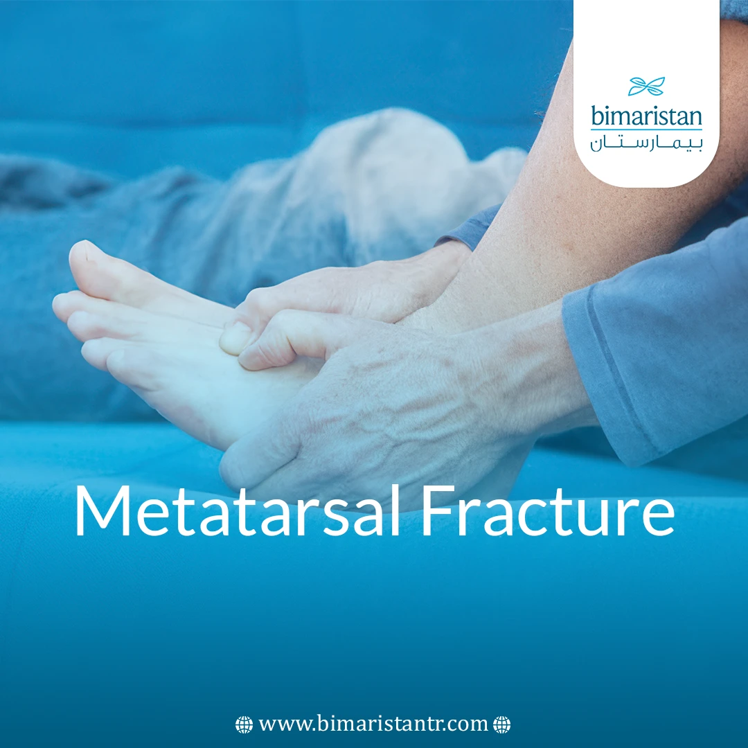 Metatarsal Fracture
