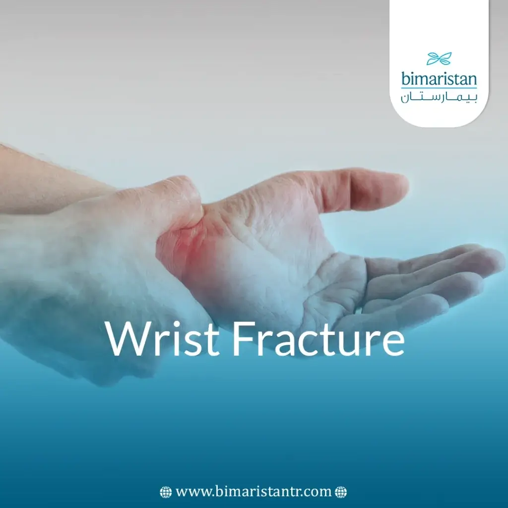 Wrist Fracture