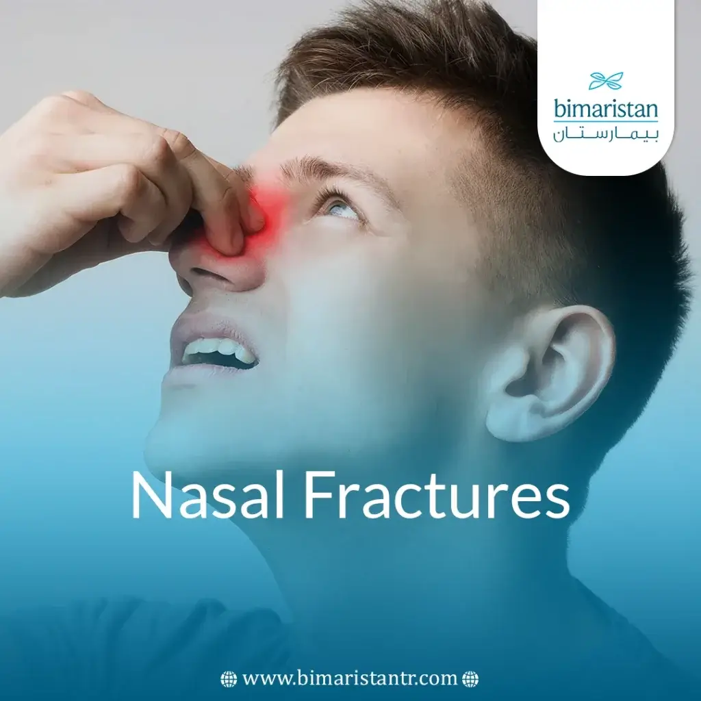 Nasal Fracture