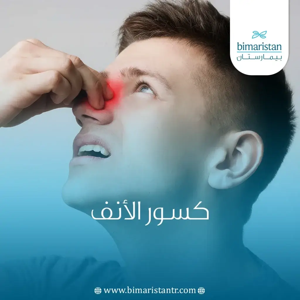 علاج كسر الأنف
