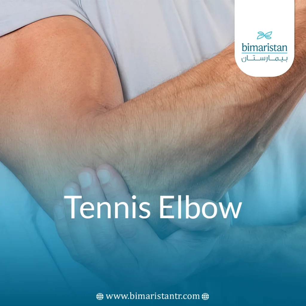 Tennis Elbow