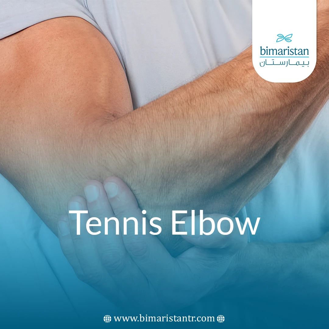 Tennis Elbow