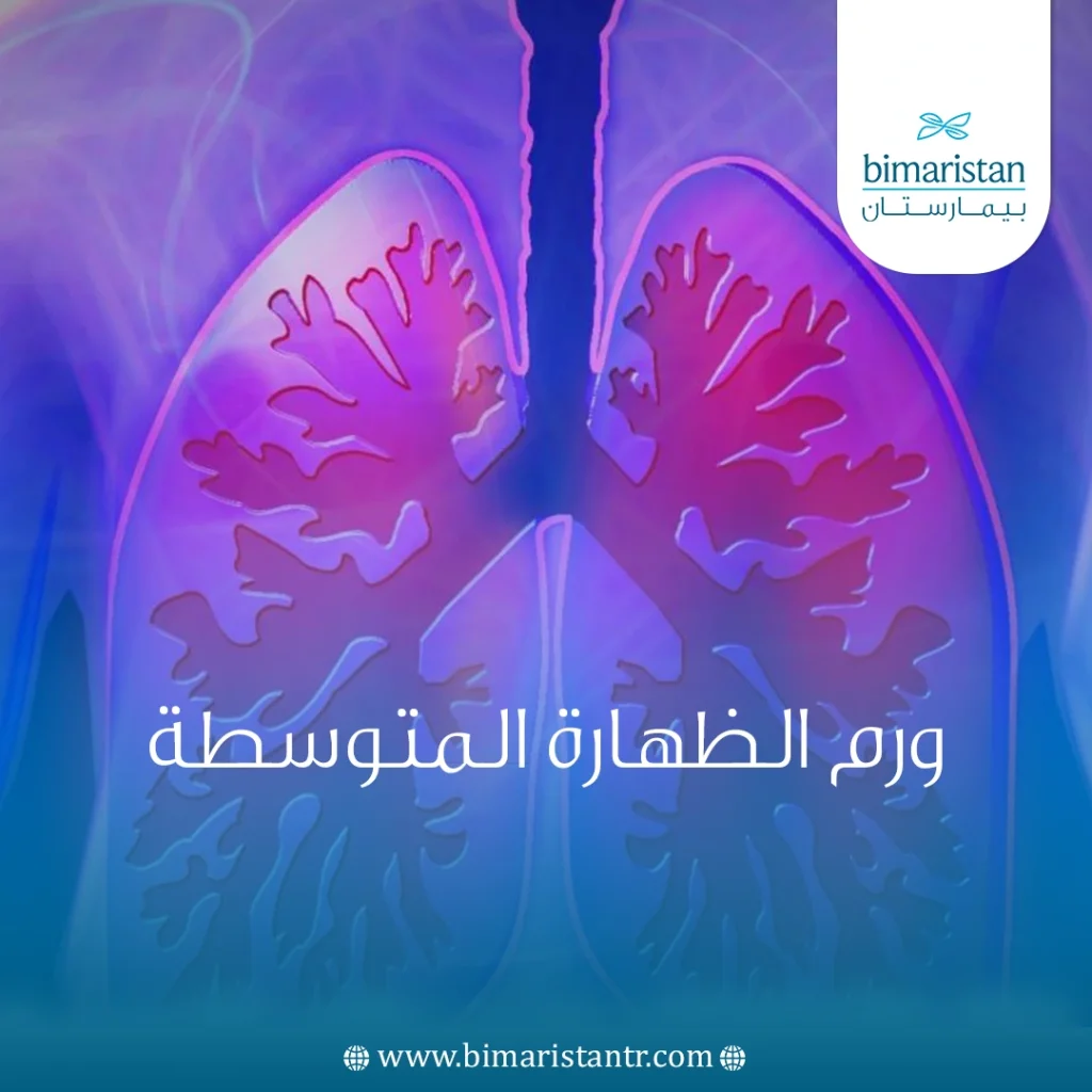 علاج ورم الظهارة المتوسطة في تركيا