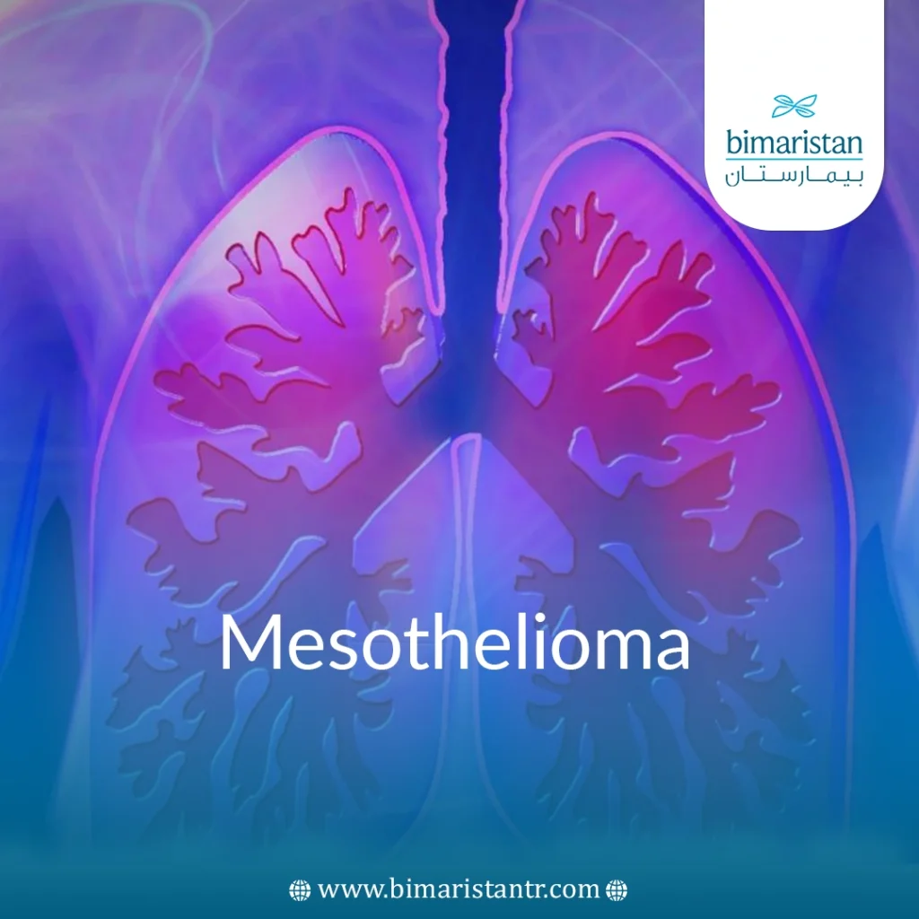 Mesothelioma Treatment In Turkey - Bimaristan
