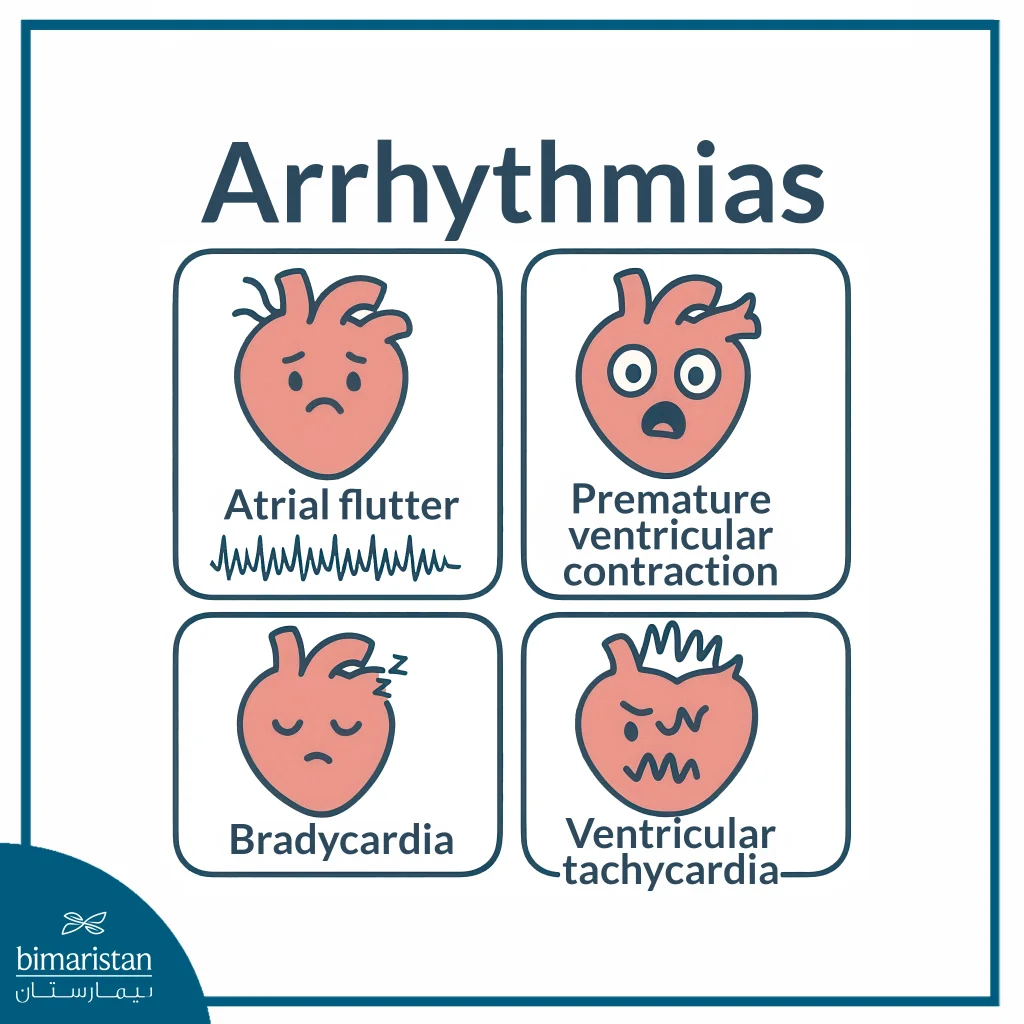 Cardiac Arrhythmias: Causes, Types, And Modern Diagnosis Methods 3 Some Types Of Cardiac Arrhythmias
