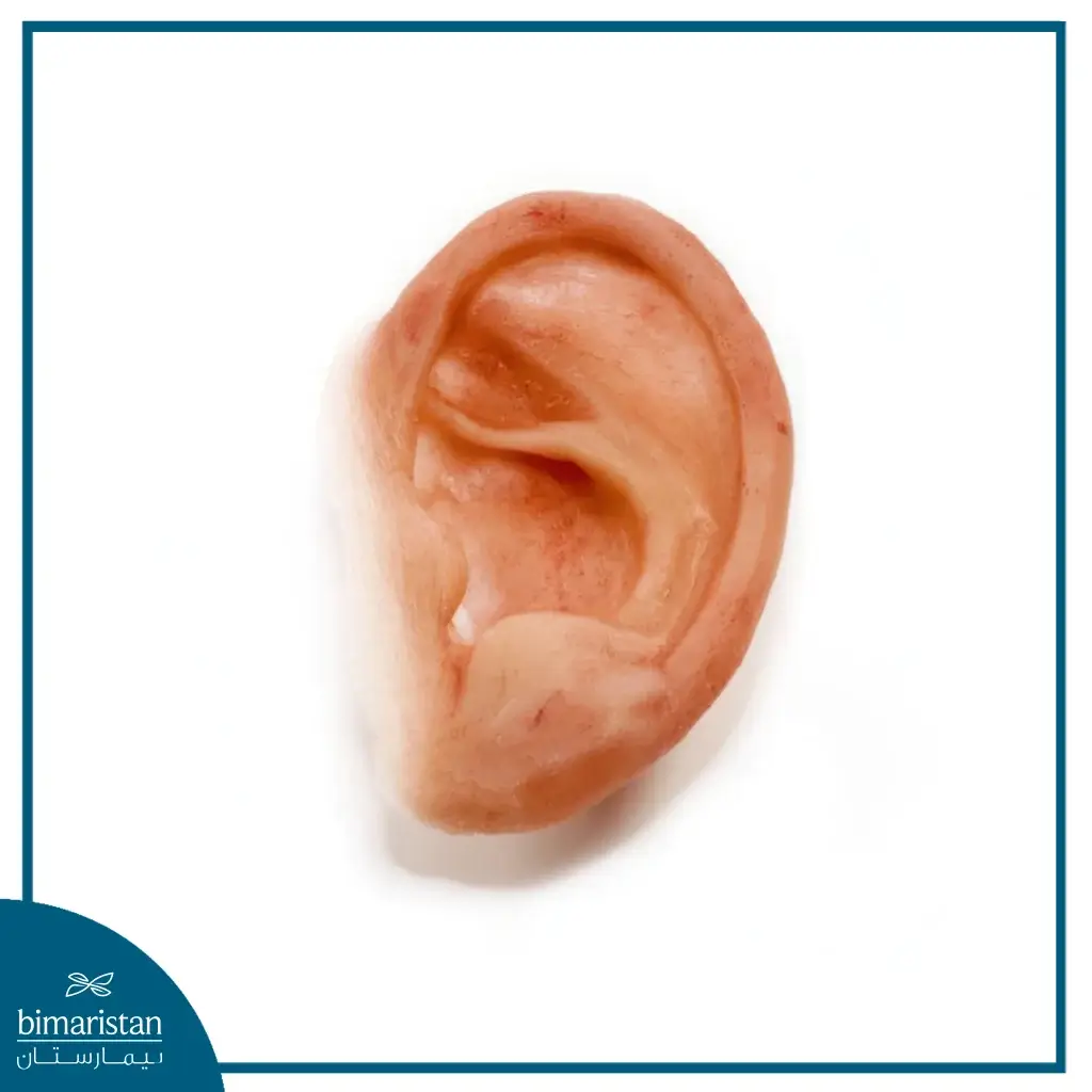 Silicone Prosthetics: The Future Of Aesthetic And Functional Restoration 3 Silicone Prosthetics: A Silicone Prosthetic Ear