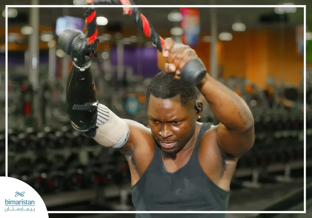 Upper Limb Prosthetics: Restore Mobility And Quality Of Life 7 Image Of An Upper Prosthesis For Sports Activities
