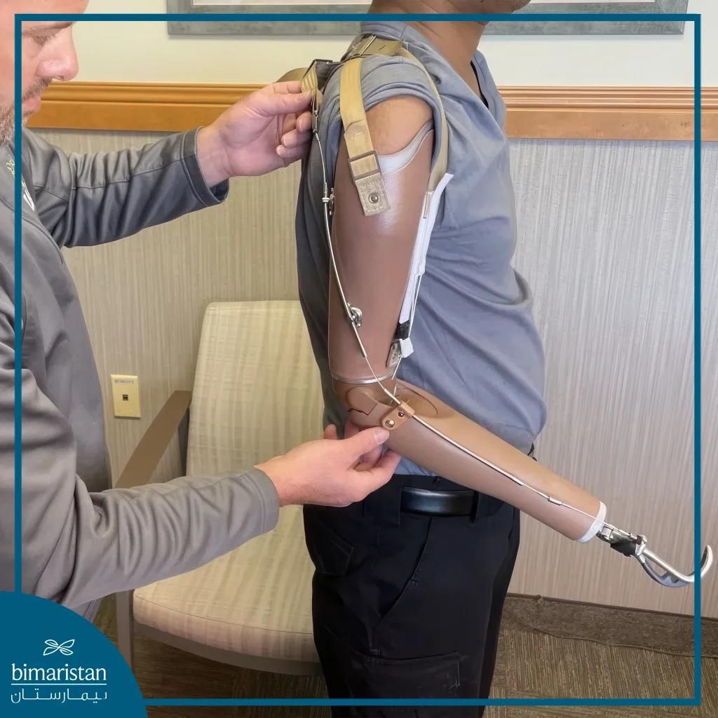 Upper Limb Prosthetics: Restore Mobility And Quality Of Life 3 Body-Powered Upper Limb Prosthetics