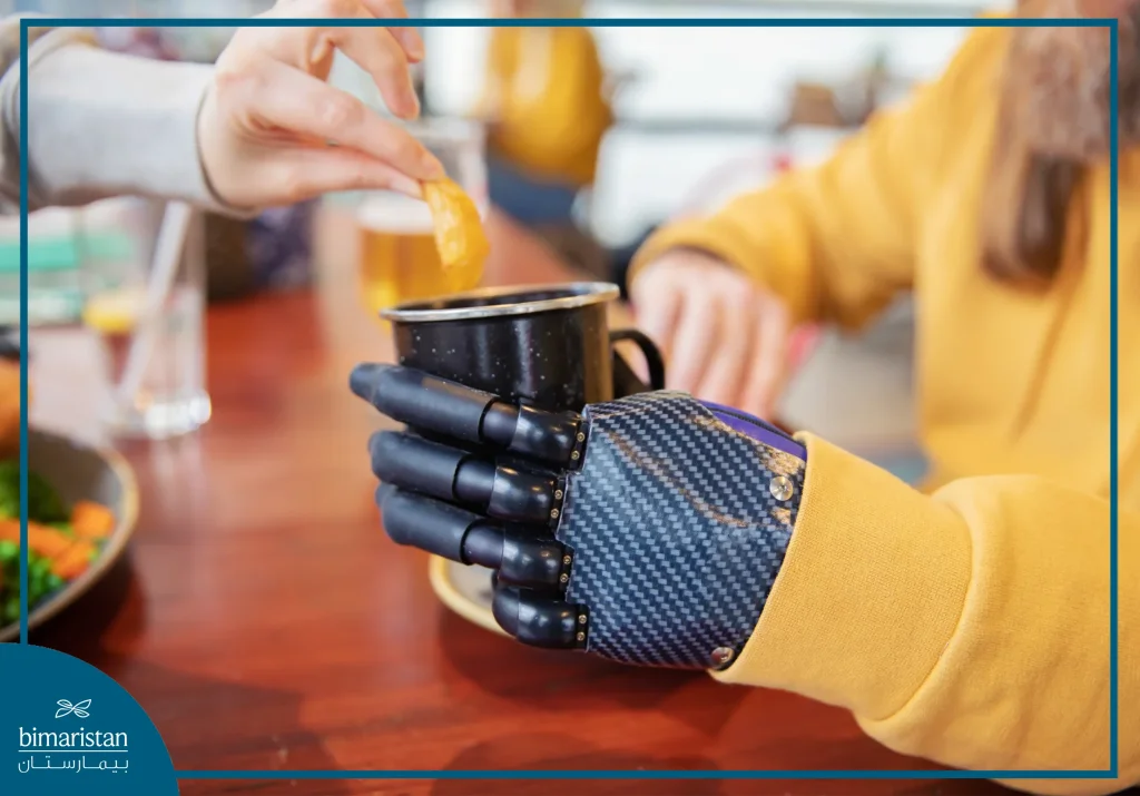 Upper Limb Prosthetics: Restore Mobility And Quality Of Life 5 I-Digits Fingers