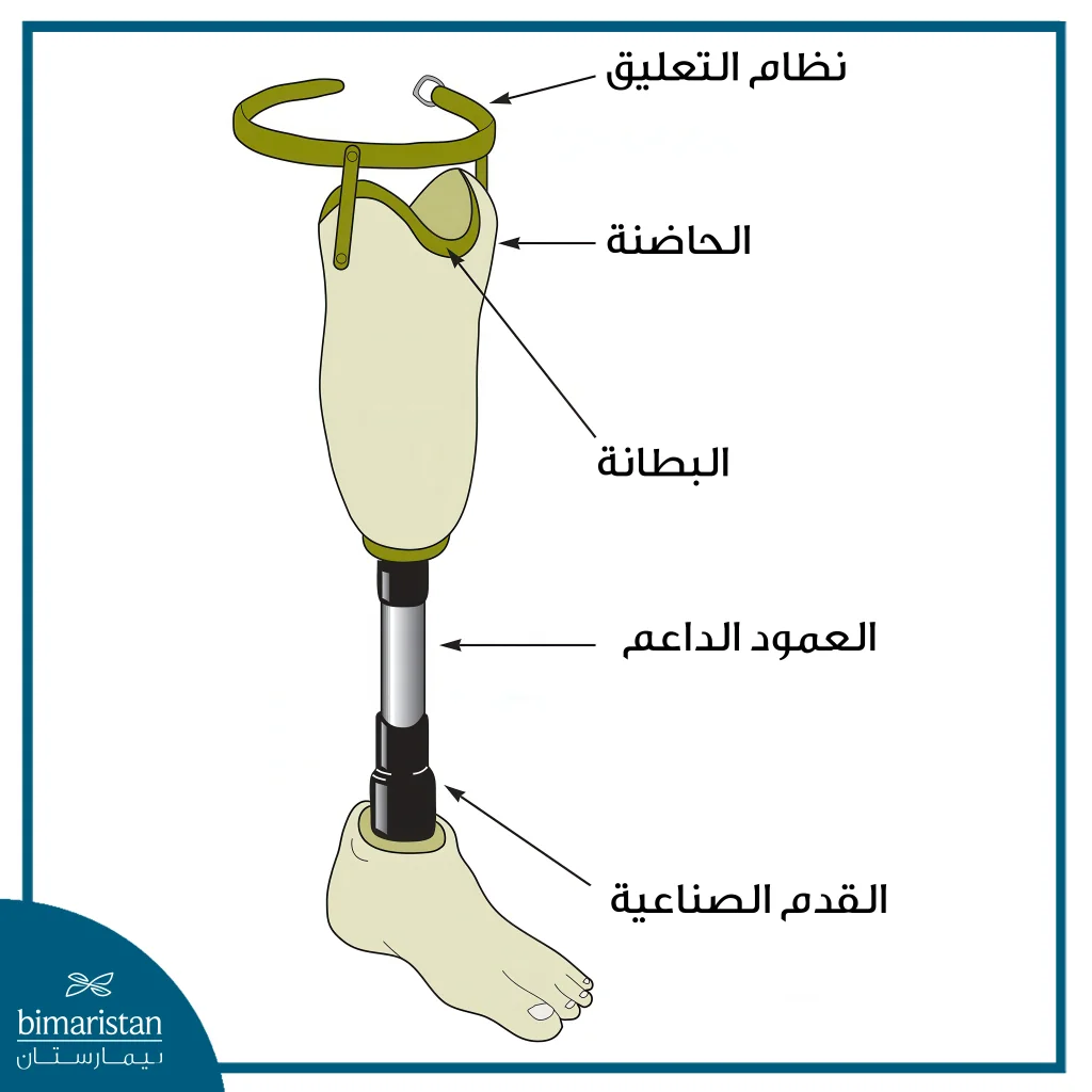الأطراف الصناعية للبتر تحت الركبة: أنواعها، مكوناتها، وطريقة اختيار الأنسب 2 صورة توضح مكونات الأطراف الصناعية للبتر تحت الركبة