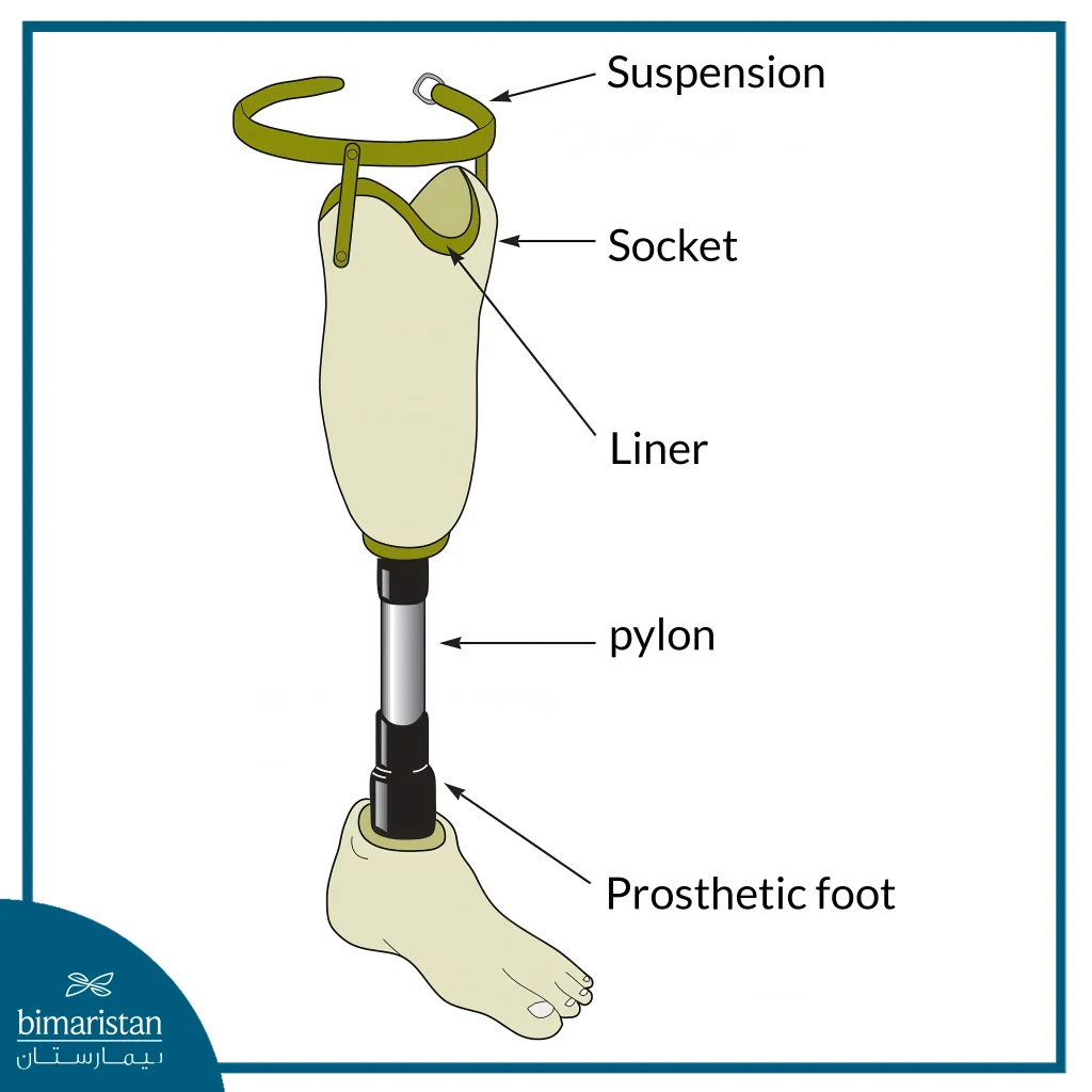 Below-Knee Prosthesis: Types, Parts &Amp; How To Choose 2 Image Showing Prosthetic Components For A Below-Knee Prosthesis