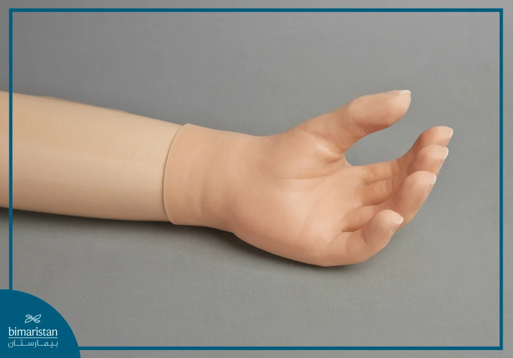 A Real Photo Showing The Similarity Between A Real And A Cosmetic Hand