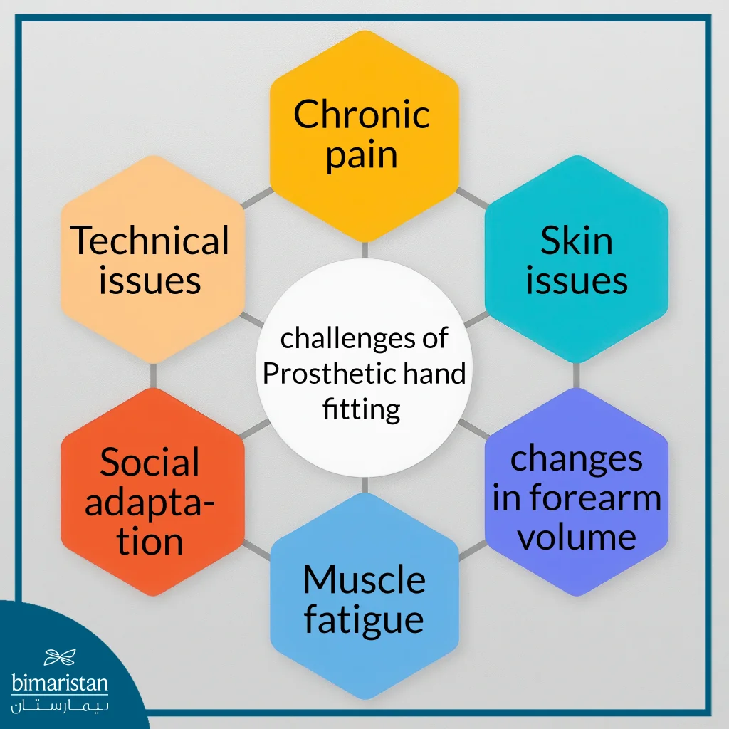 The Most Important Challenges That Can Be Encountered After Prosthetic Hand Fitting