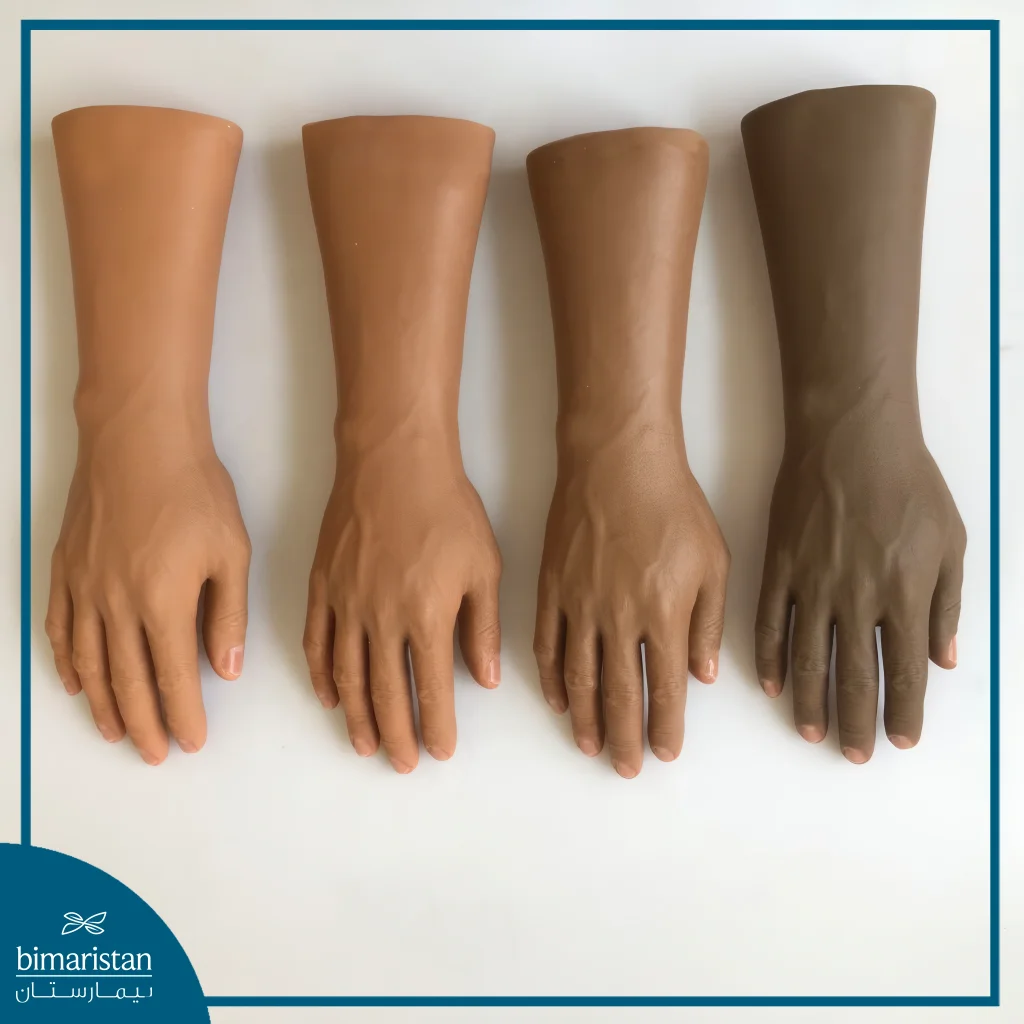 Silicone Limb Prosthesis Can Mimic The Color Of Normal Skin