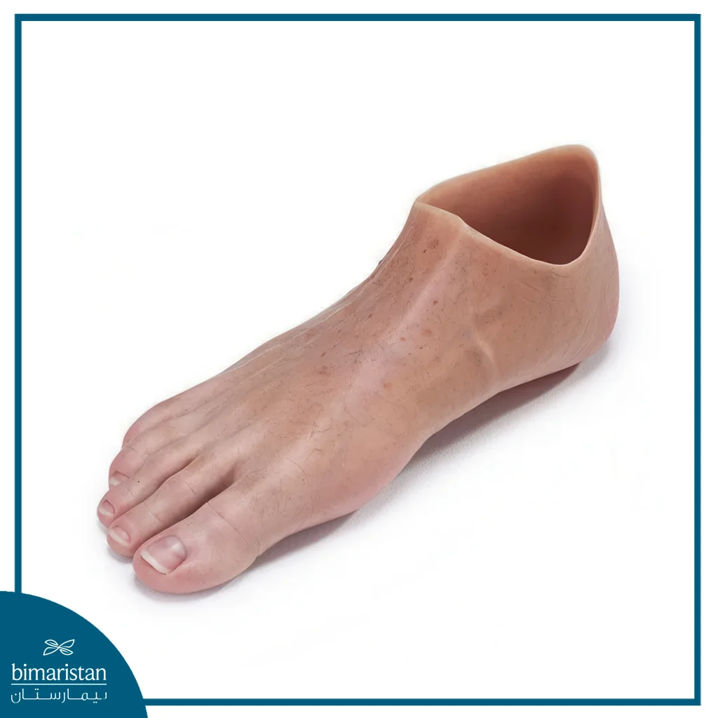 Silicone Limb Prosthesis: Silicone Foot
