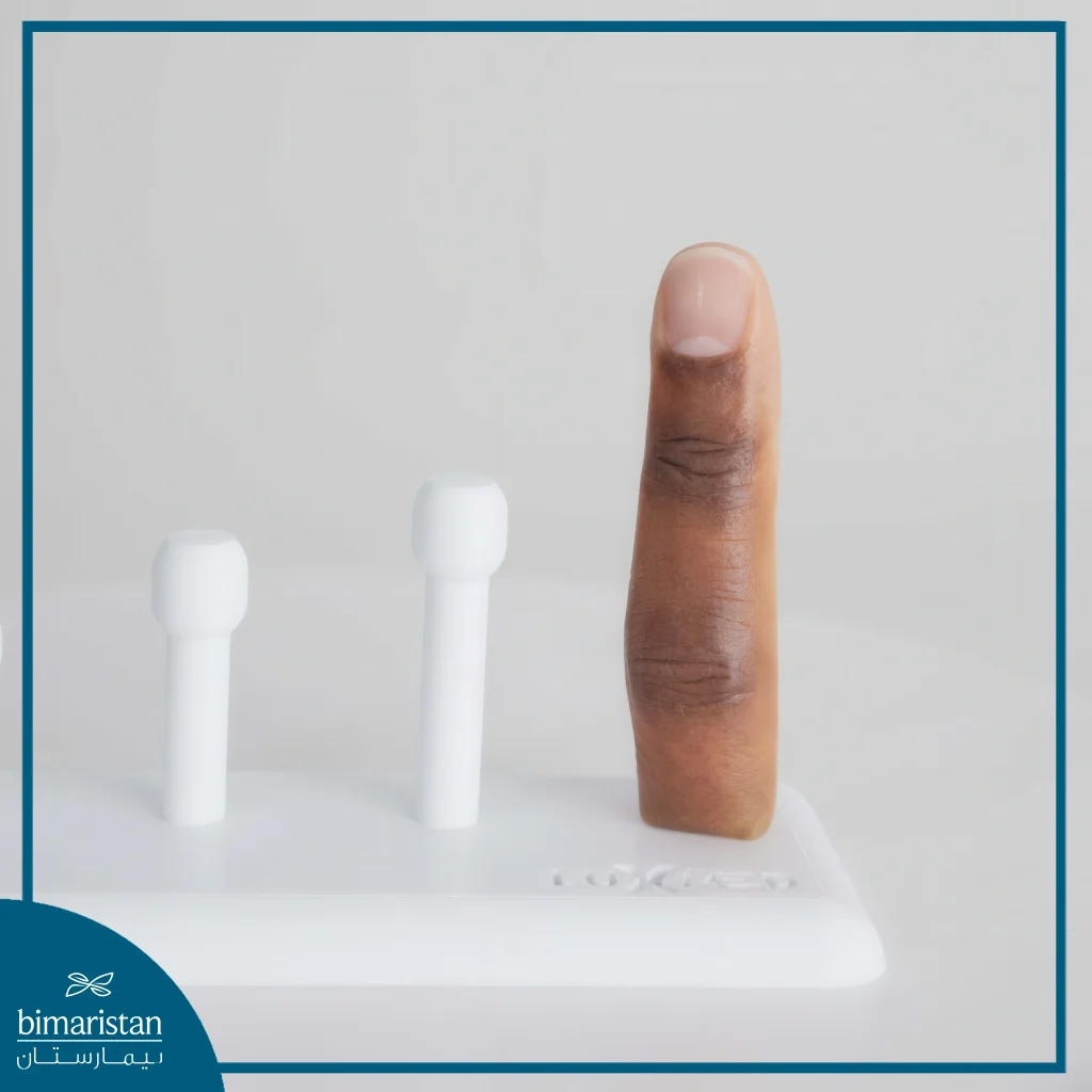 Silicone Limb Prosthesis: Silicone Finger