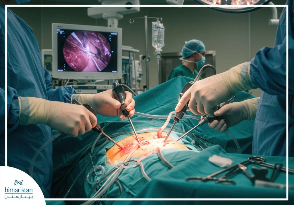 Post-Endoscopic Heart Surgery Care: A Complete Guide To Safe Recovery 2 An Image Showing Endoscopic Heart Surgery