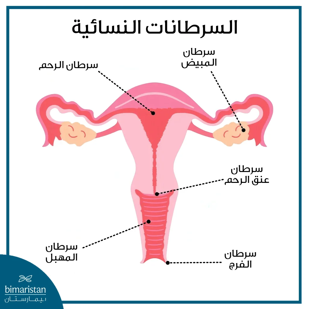 السرطانات النسائية: الأنواع، الأسباب، الأعراض وخيارات العلاج 2 صورة توضح أبرز أنواع السرطانات النسائية ومواقعها