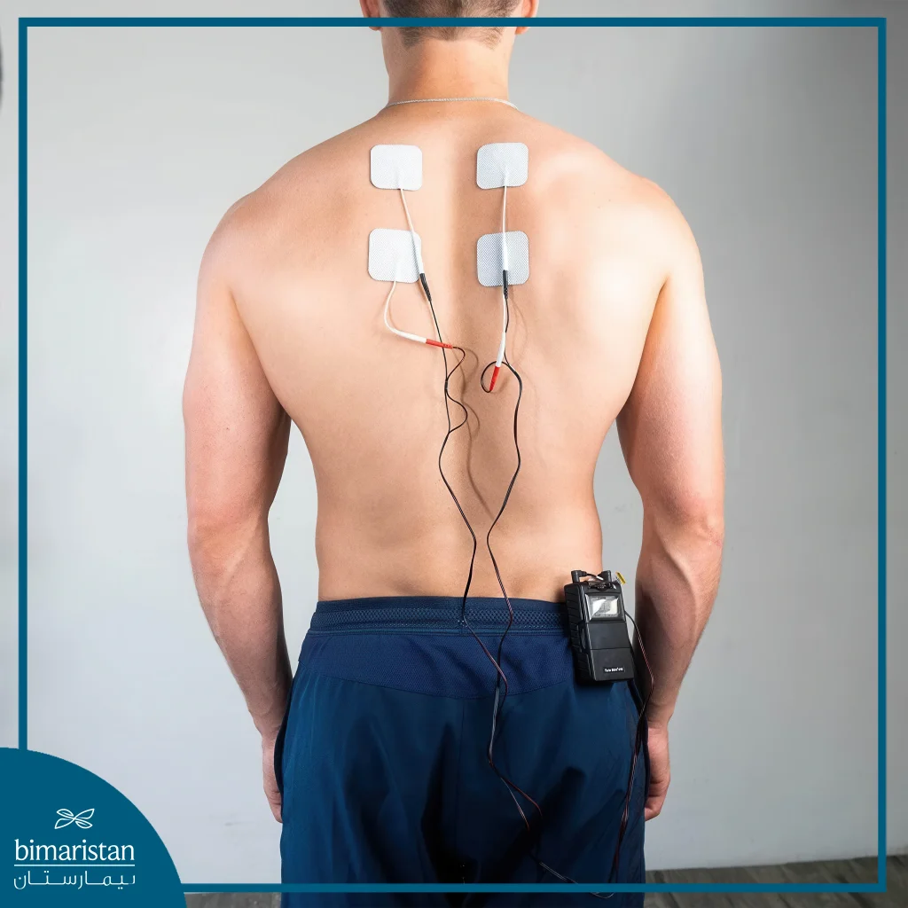 Electrical Nerve Stimulation (Tens) Is A Chronic Pain Physiotherapy Technique.