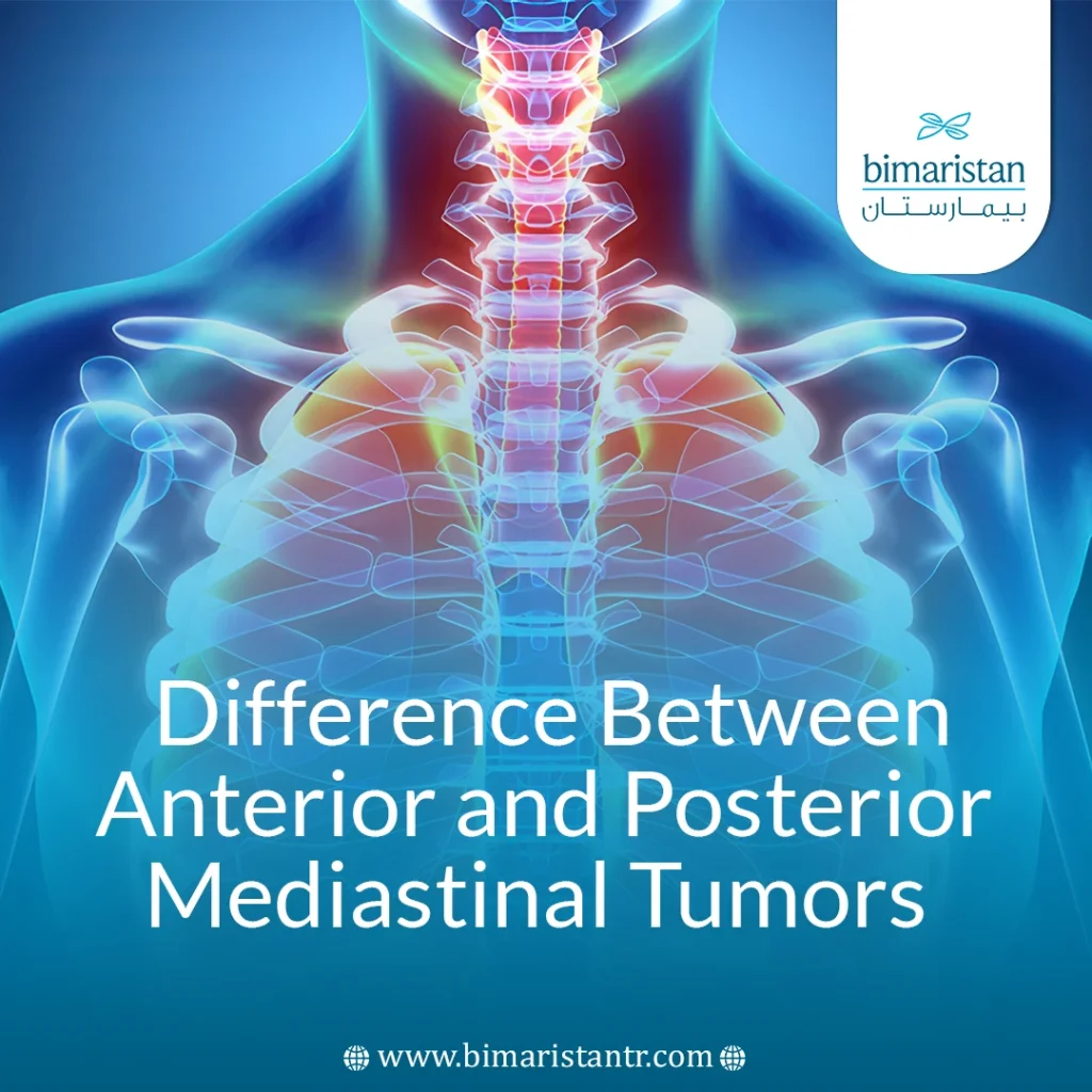 Difference Between Anterior and Posterior Mediastinal Tumors