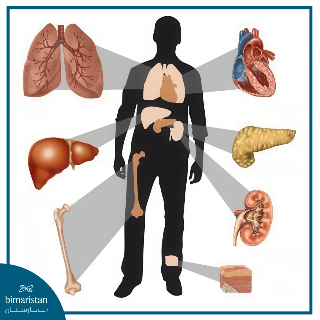 Organ Transplant Cost In Turkey: The Comprehensive Guide 2025 2 Organ Transplant Cost In Turkey: An Image Showing Some Organs That Can Be Transplanted