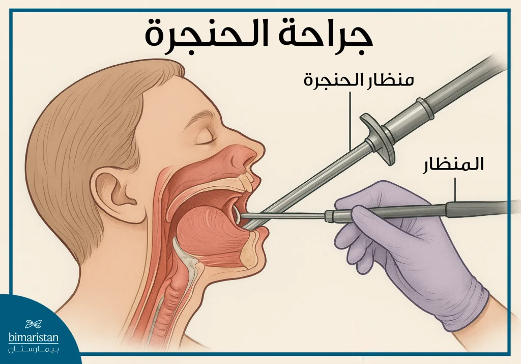 جراحة الحنجرة: متى تحتاج إليها وما الخيارات المتاحة؟ 2 صورة توضح عملية جراحة الحنجرة وأدواتها