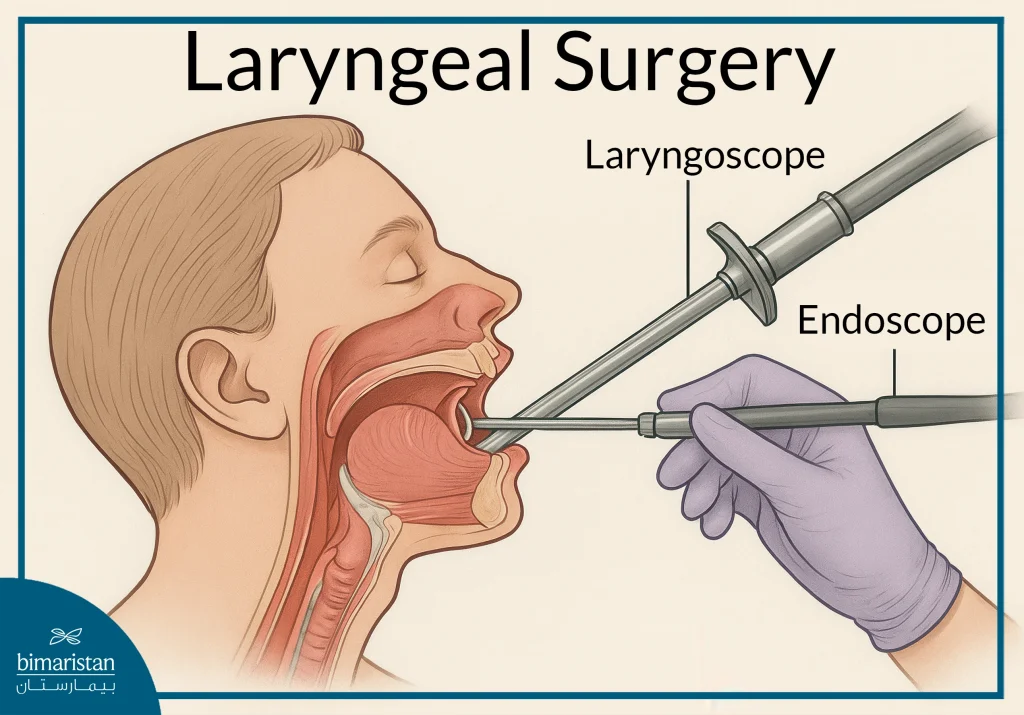 Laryngeal Surgery: When Do You Need It And What Are The Options? 2 Laryngoscope