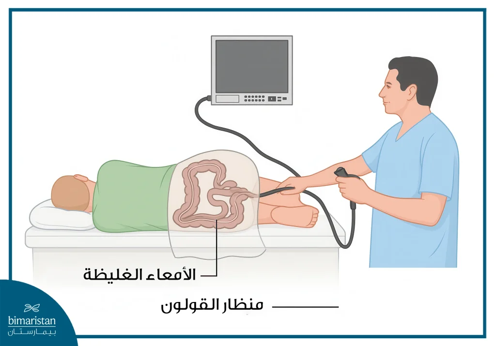 صورة توضح إجراء جراحة القولون بالموجات فوق الصوتية
