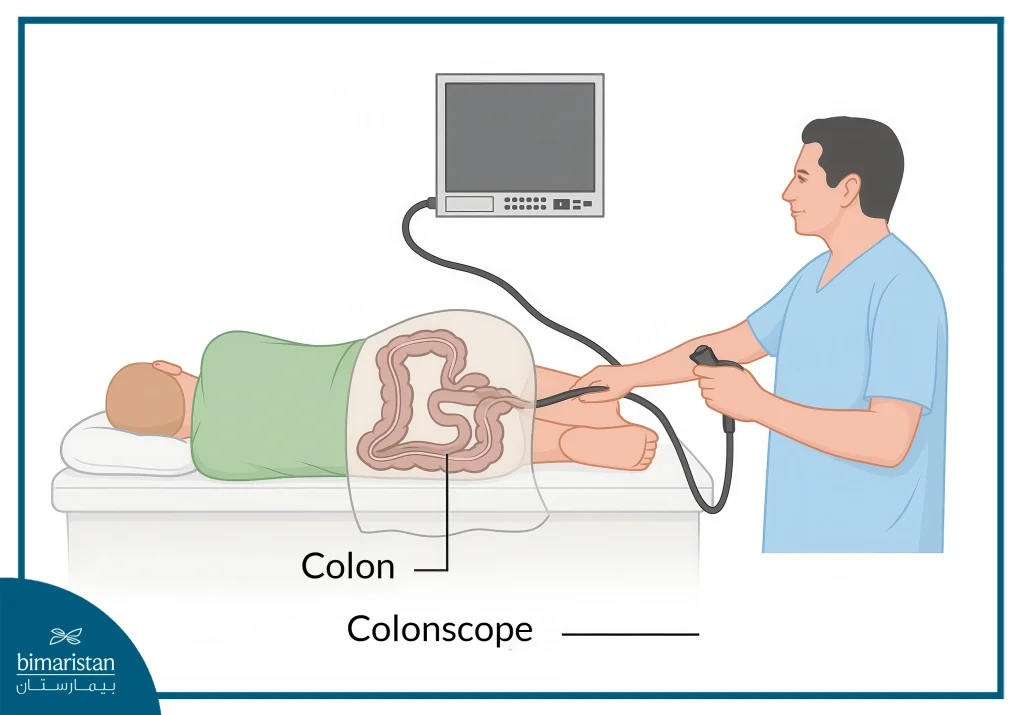 Colonscopic Ultrasound Procedure: Uses, Steps, And Recovery 3 An Image Showing A Colonscopic Ultrasound Procedure