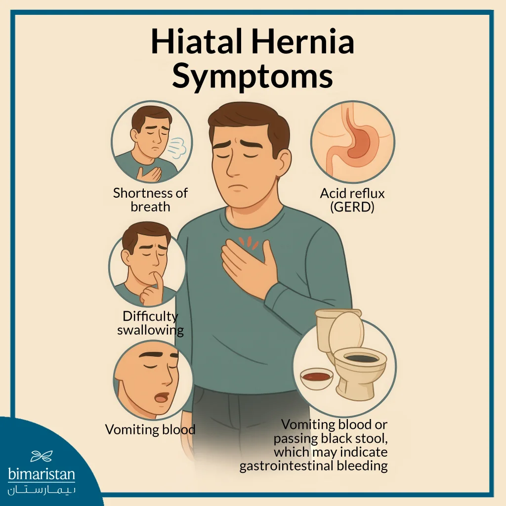 Treating Hiatal Hernia Symptoms With Laparoscopic Hiatal Hernia Repair