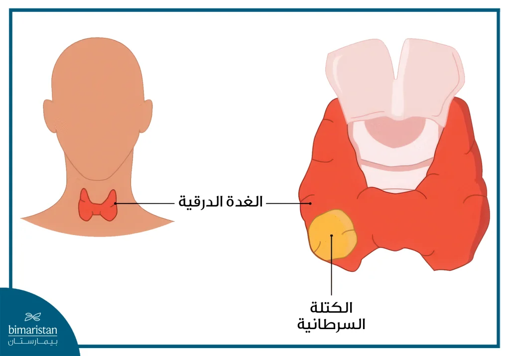 سرطان الغدة الدرقية: علامات و أعراض وطرق علاج 3 تموضع الغدة الدرقية الطبيعي في العنق