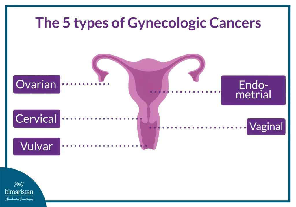 Gynecologic Cancer Treatment: Advanced Methods And Cure Rates 2 Image Showing The Locations Of The Five Cancers Treated In Gynecologic Cancer Treatment.