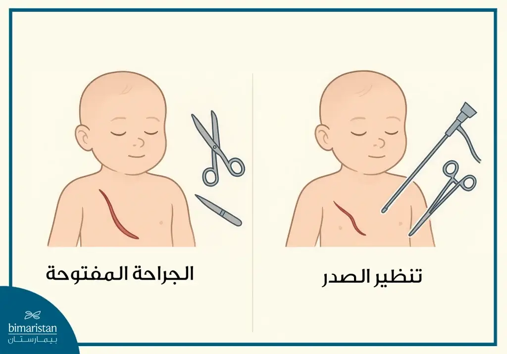 طرق علاج رتق المريء والناسور الرغامي