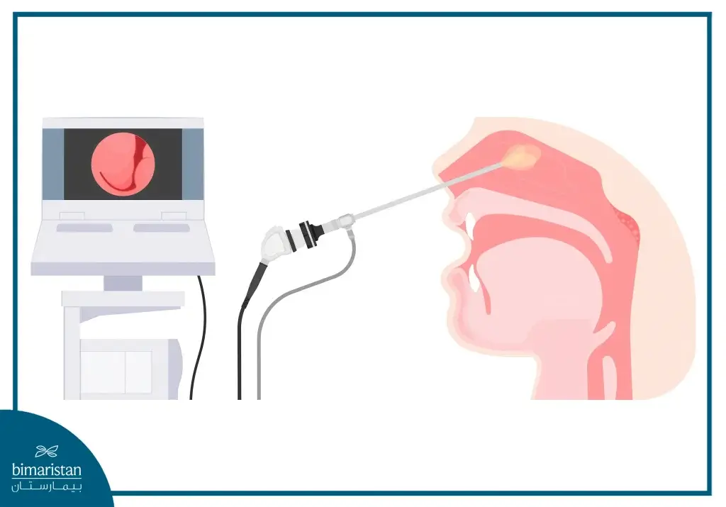 Functional Endoscopic Sinus Surgery: Sinusitis Treatment &Amp; Recovery Guide 2 Image Showing Functional Endoscopic Sinus Surgery