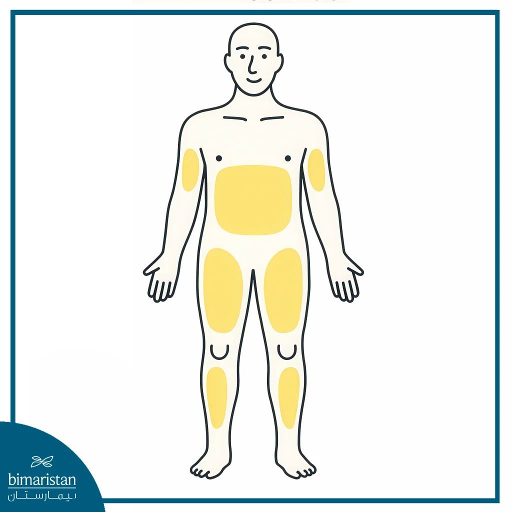Liposuction Cost In Turkey Varies Depending On The Number Of Areas To Be Suctioned.
