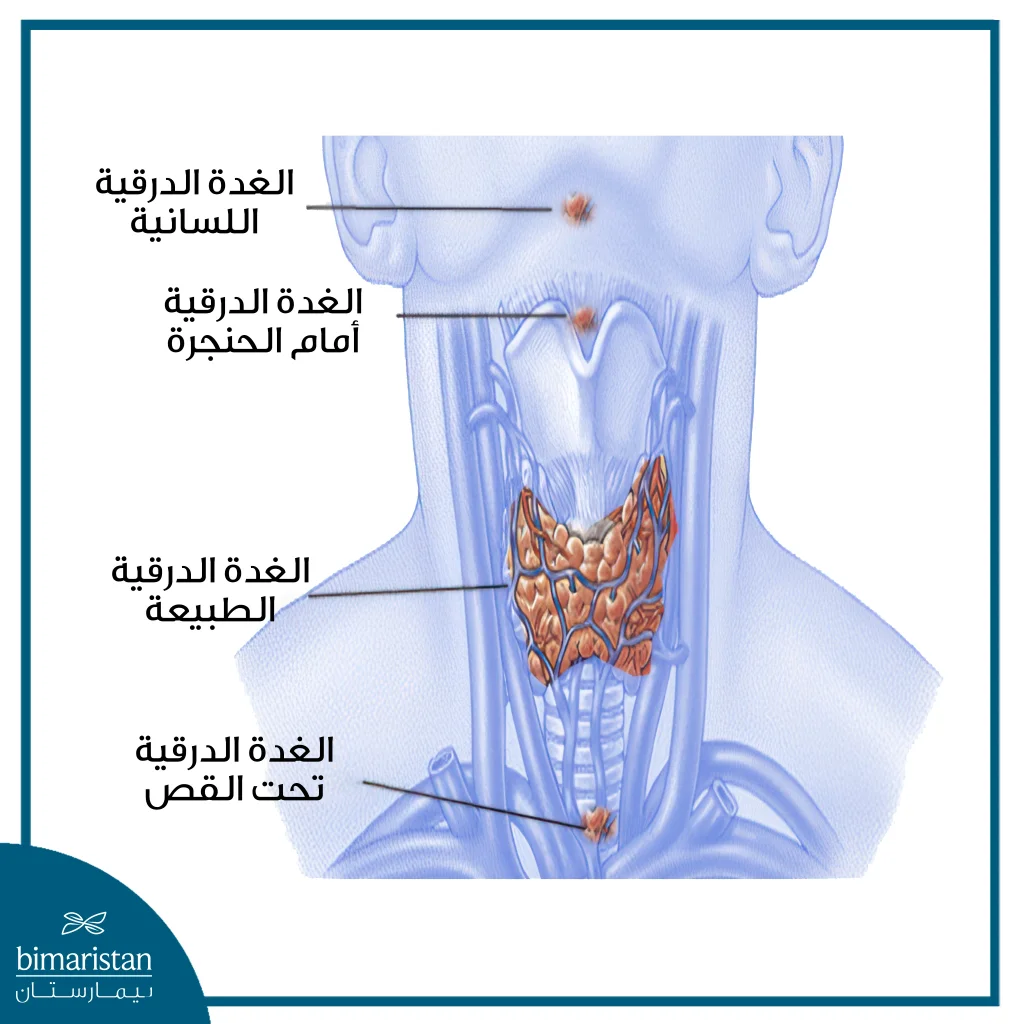كيس الدرق اللساني: ما هو وكيف يتم استئصاله جراحياً؟ 3 أنواع الكيسات الدرقية
