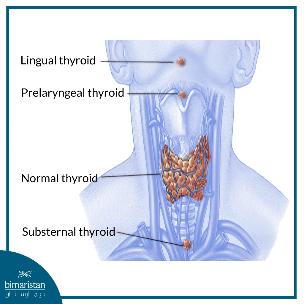 Thyroglossal Duct Cyst: What It Is And How It'S Surgically Removed 3 Types Of Thyroid Cysts