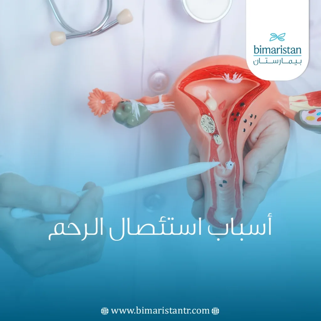 أسباب استئصال الرحم