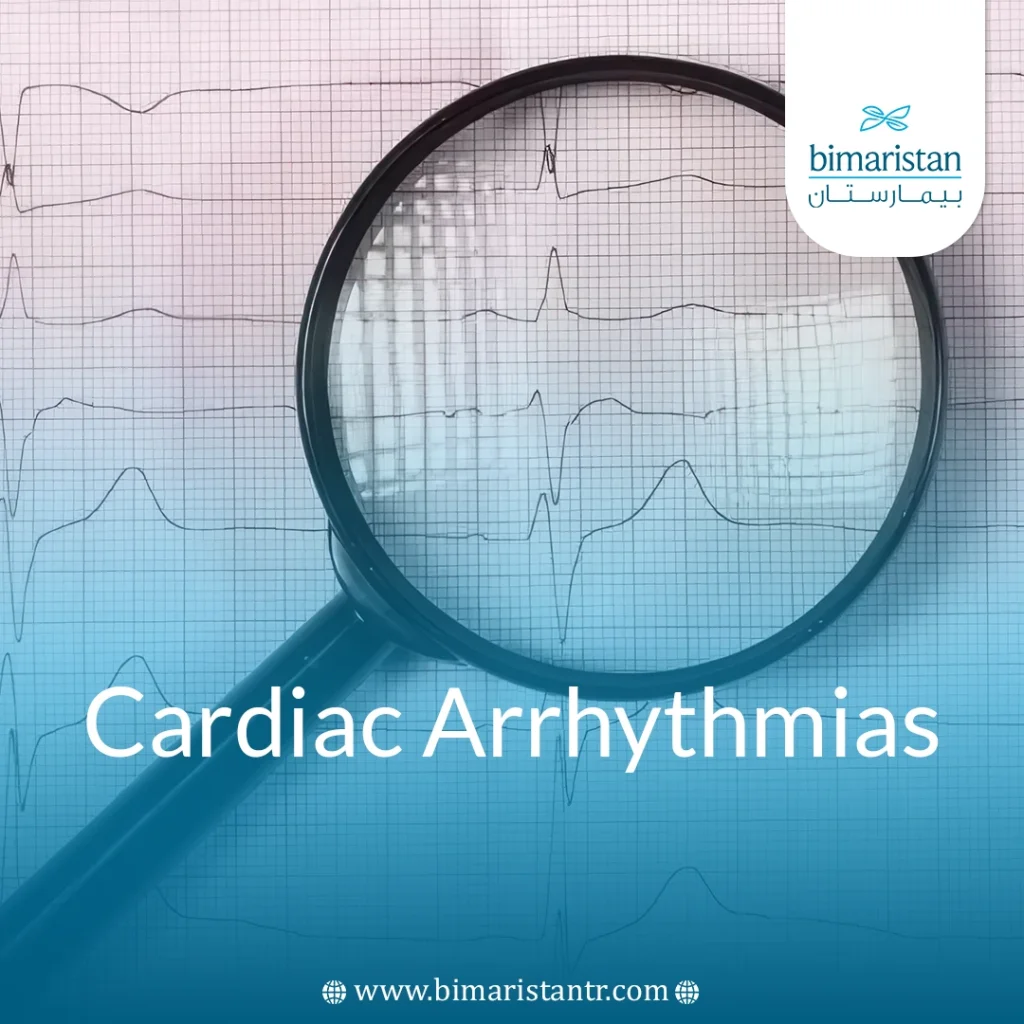 Cardiac Arrhythmias: Causes, Types &Amp; Modern Diagnosis
