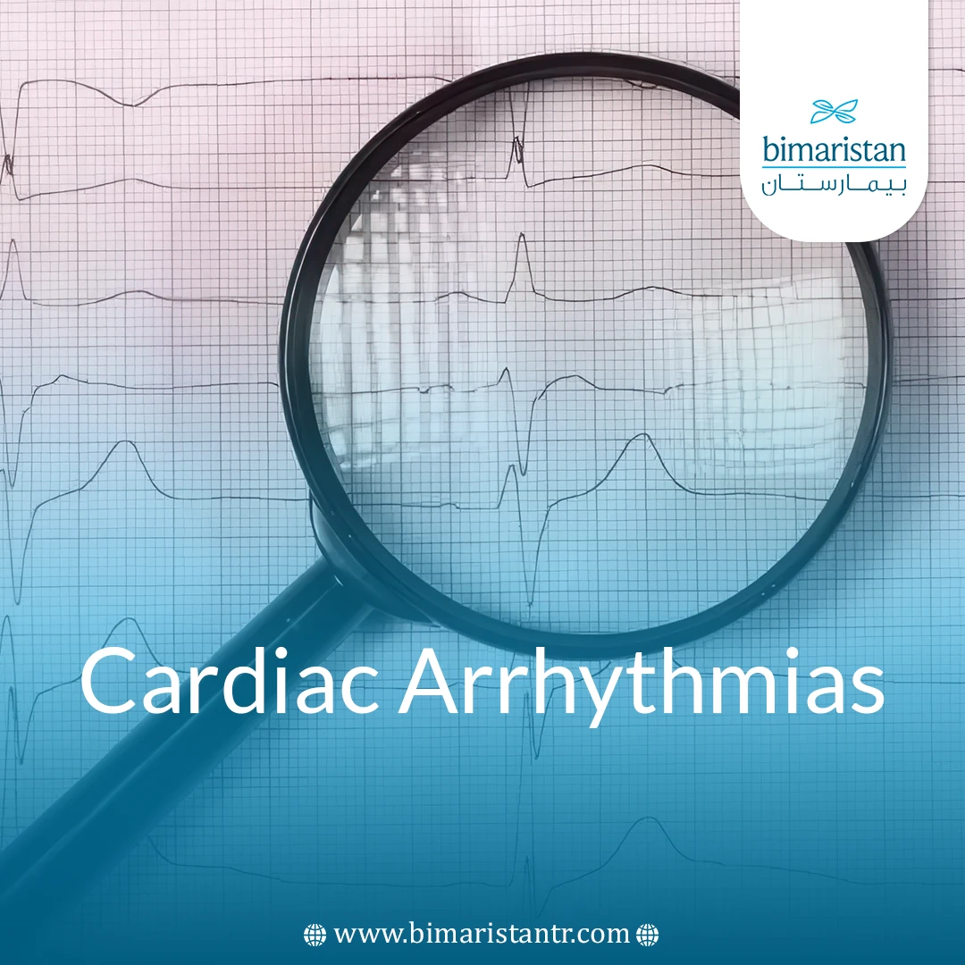 Cardiac Arrhythmias: Causes, Types &Amp;Amp; Modern Diagnosis