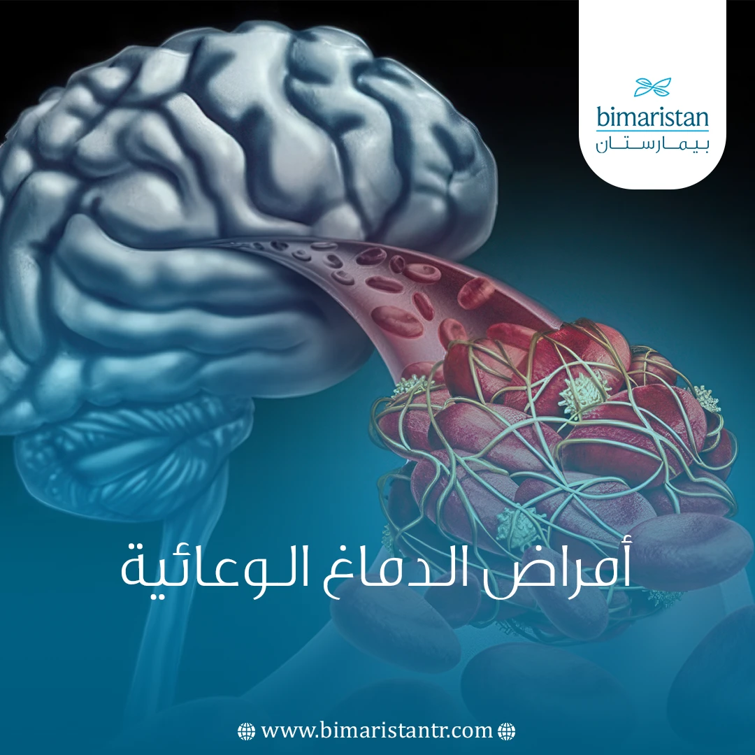 أمراض الدماغ الوعائية
