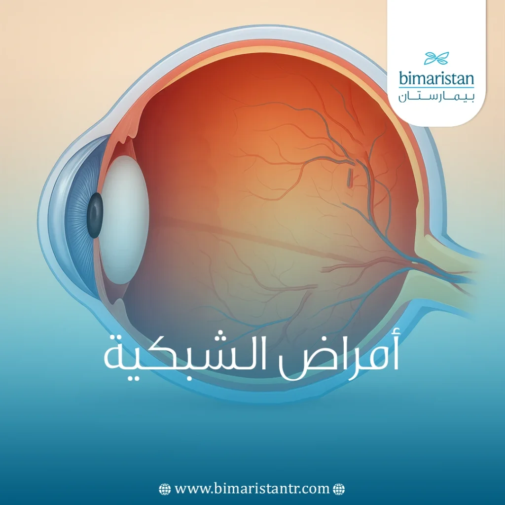 أمراض الشبكية