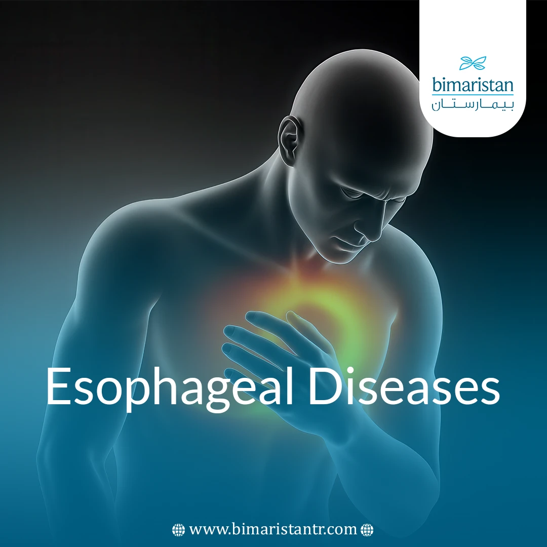 Esophageal Diseases: Common Disorders &Amp;Amp; Their Causes