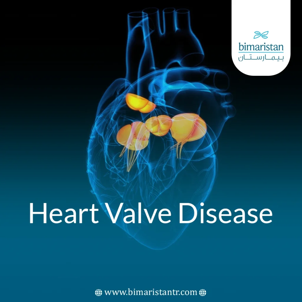 Heart Valve Disease: Causes, Signs &Amp; Modern Treatments