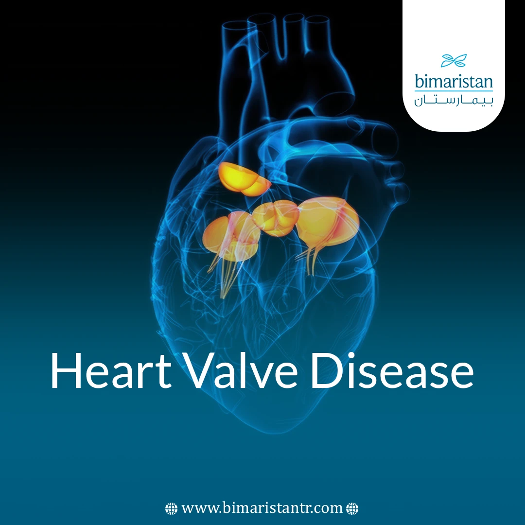 Heart Valve Disease: Causes, Signs &Amp;Amp; Modern Treatments