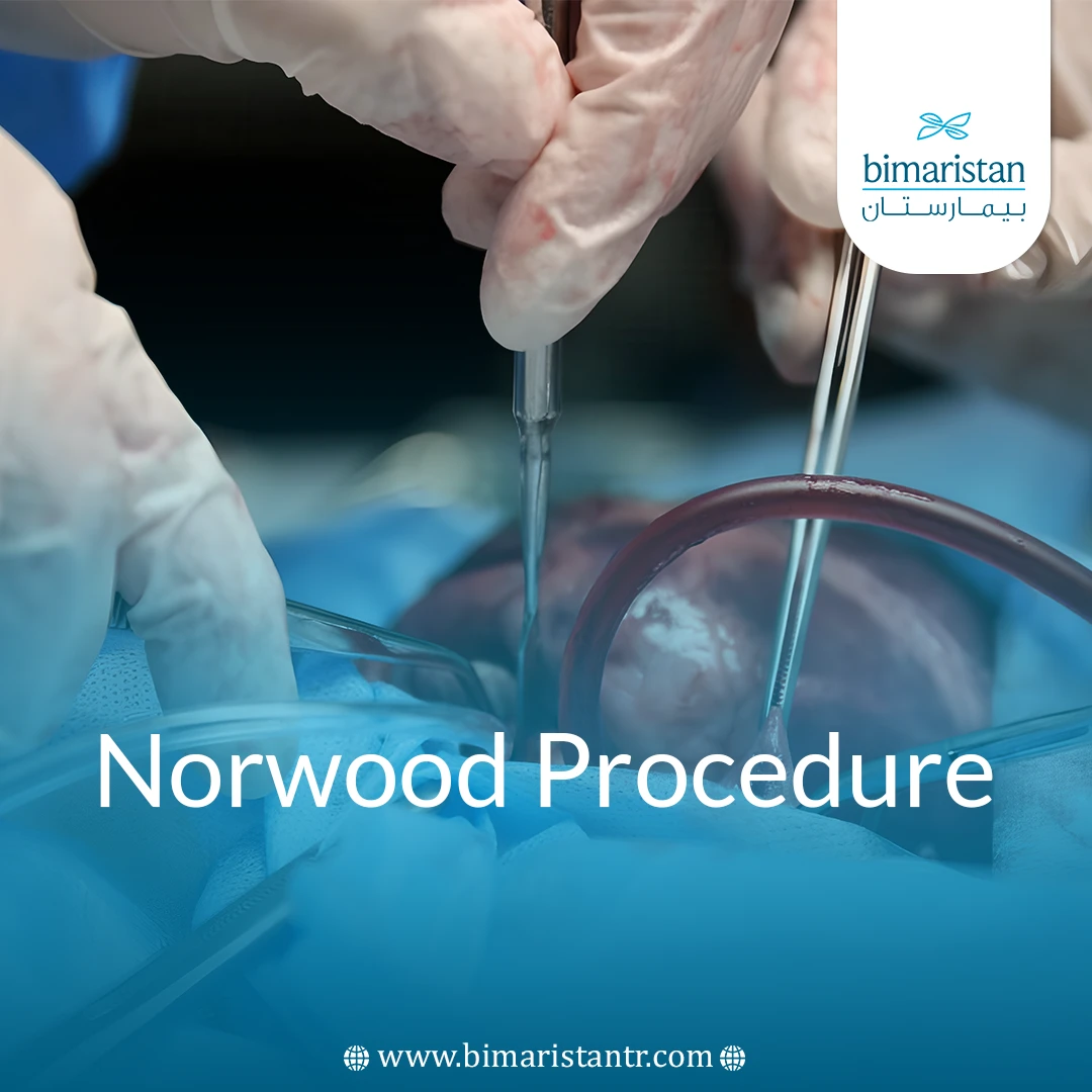 Norwood Procedure: Surgical Hope For Children With Defects
