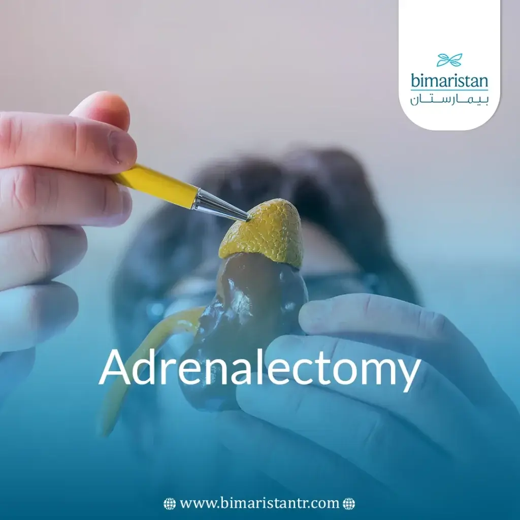 Adrenalectomy: Procedure, Benefits &Amp; Hormonal Impact